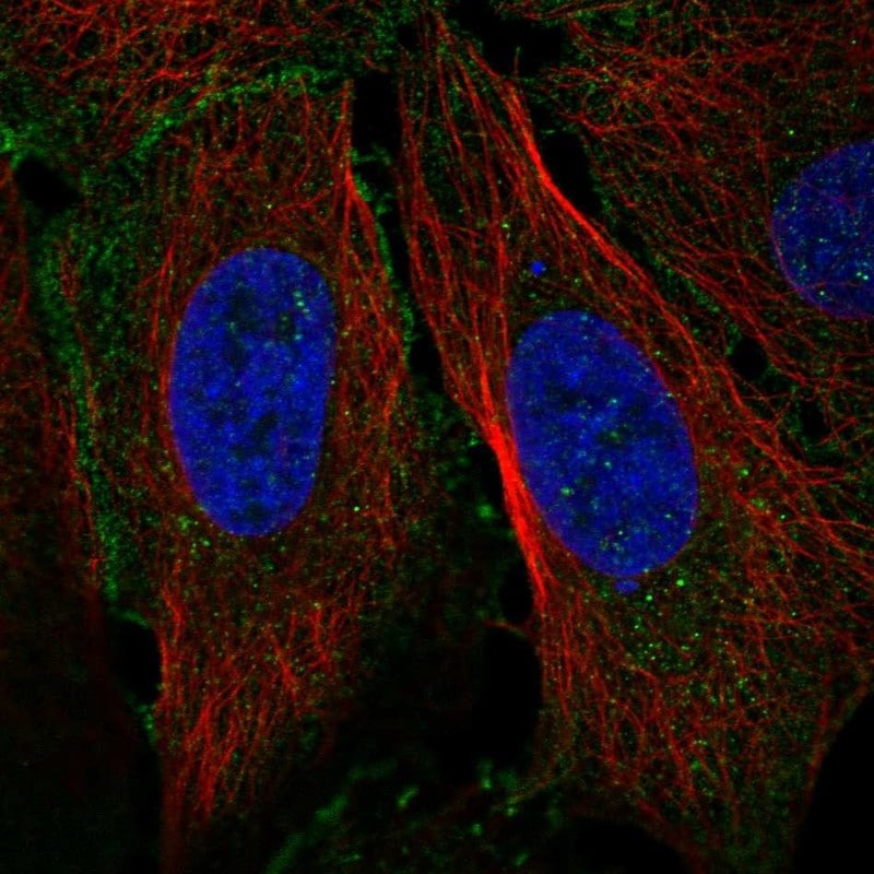 Claudin-19 Antibody Immunocytochemistry/Immunofluorescence: Claudin-19 Antibody [NBP3-24745]
