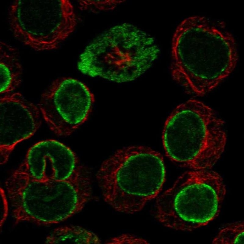 CPNE1 Antibody Immunocytochemistry/Immunofluorescence: CPNE1 Antibody [NBP3-24761]