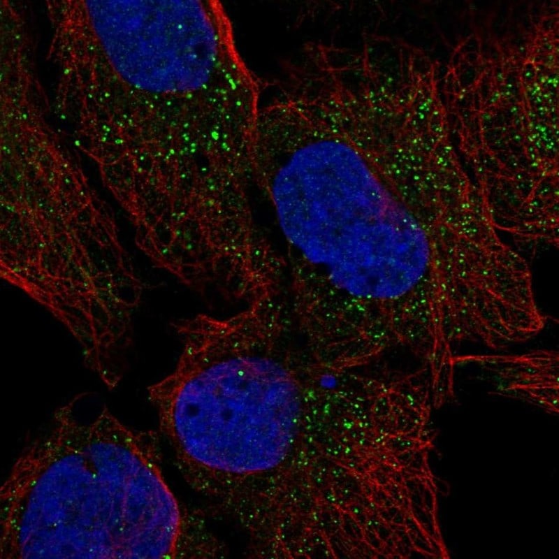 CRISPLD2 Antibody Immunocytochemistry/Immunofluorescence: CRISPLD2 Antibody [NBP3-24765]