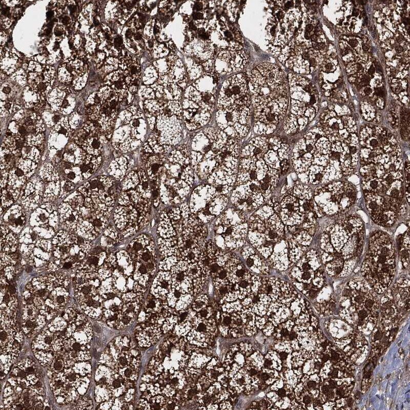 CutA Antibody Immunohistochemistry-Paraffin: CutA Antibody [NBP3-24769]