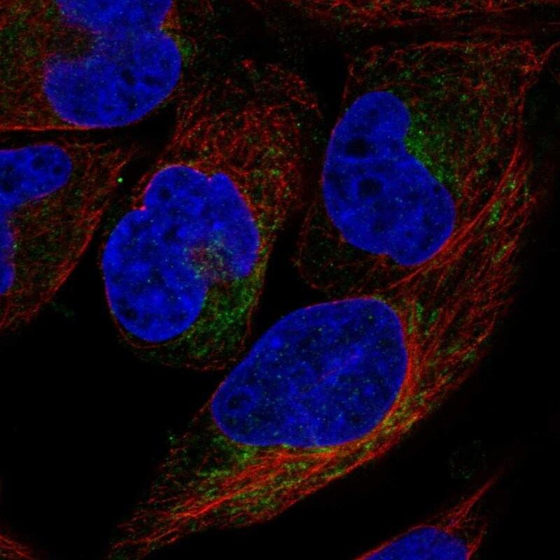 CYB5R1 Antibody Immunocytochemistry/Immunofluorescence: CYB5R1 Antibody [NBP3-24770]
