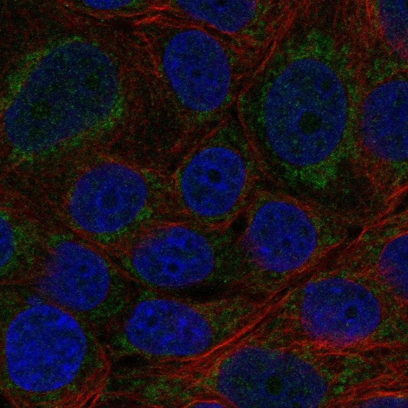 CYP11B2 Antibody Immunocytochemistry/Immunofluorescence: CYP11B2 Antibody [NBP3-24773]