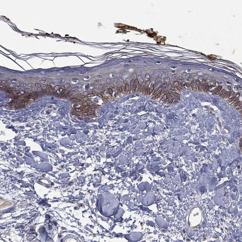 Desmoglein-4 Antibody Immunohistochemistry-Paraffin: Desmoglein-4 Antibody [NBP3-24786]