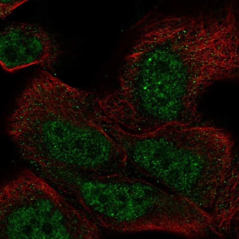 DHX36 Antibody Immunocytochemistry/Immunofluorescence: DHX36 Antibody [NBP3-24787]