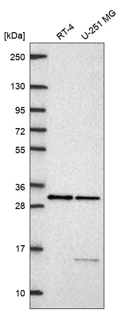 PRPK Antibody Western Blot: PRPK Antibody [NBP3-24799]
