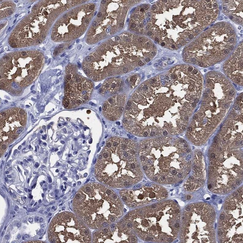 DPYS Antibody Immunohistochemistry-Paraffin: DPYS Antibody [NBP3-24800]