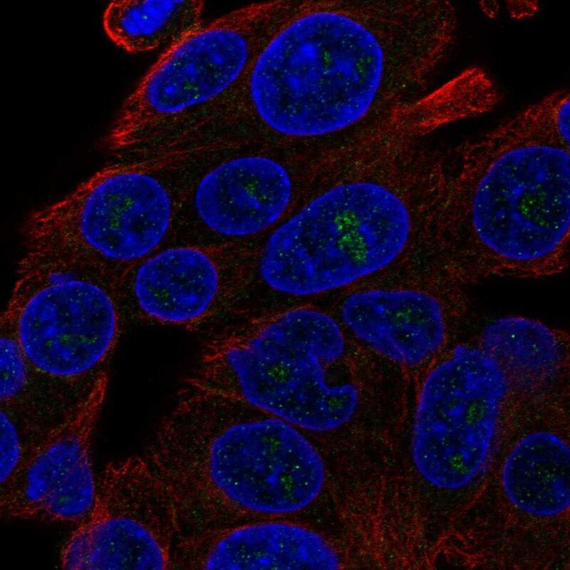 DQX1 Antibody Immunocytochemistry/Immunofluorescence: DQX1 Antibody [NBP3-24801]