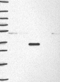 DUSP4 Antibody Western Blot: DUSP4 Antibody [NBP3-24803]