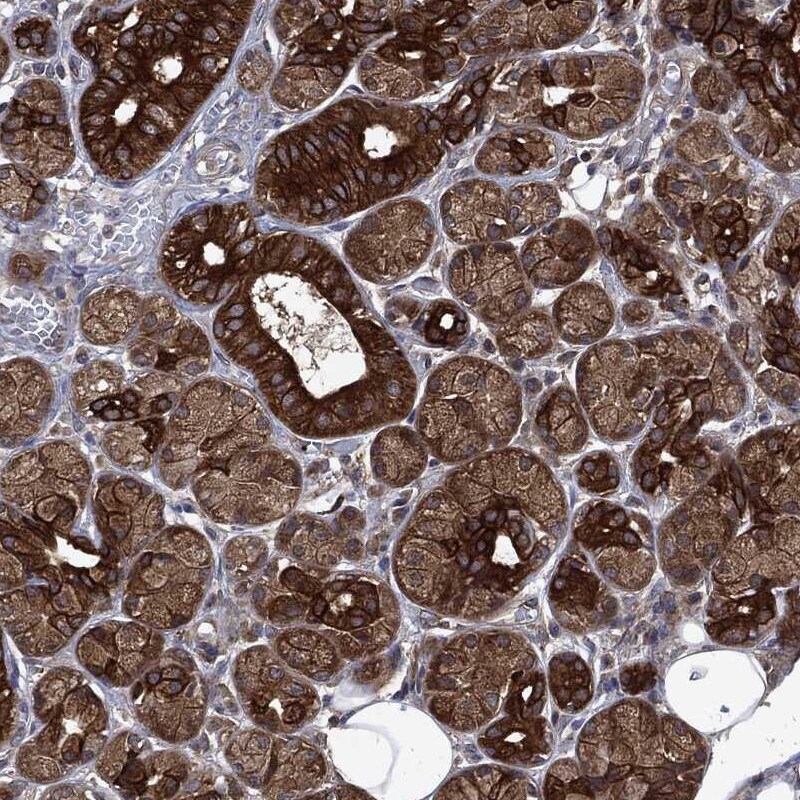 Dynactin Subunit 1/DCTN1 Antibody Immunohistochemistry-Paraffin: Dynactin Subunit 1/DCTN1 Antibody [NBP3-24804]