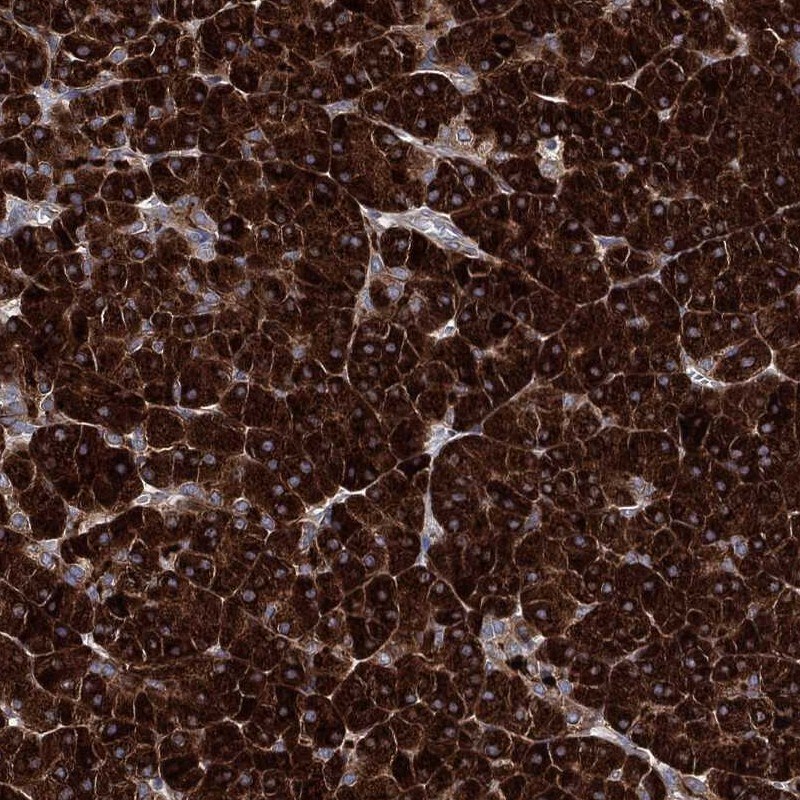 EIF2 beta Antibody Immunohistochemistry-Paraffin: EIF2 beta Antibody [NBP3-24812]