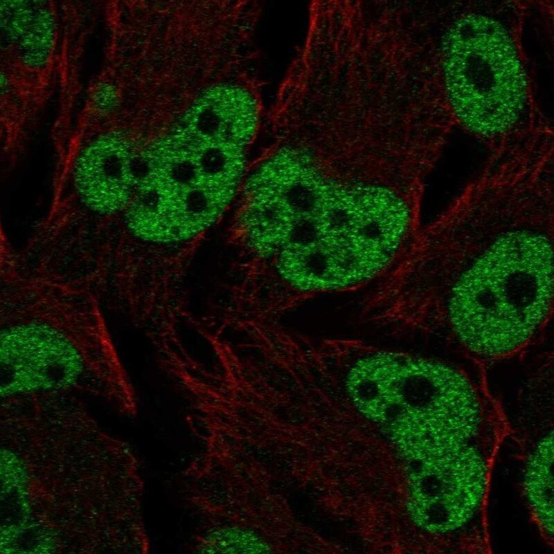 ER beta/NR3A2 Antibody Immunocytochemistry/Immunofluorescence: ER beta/NR3A2 Antibody [NBP3-24821]