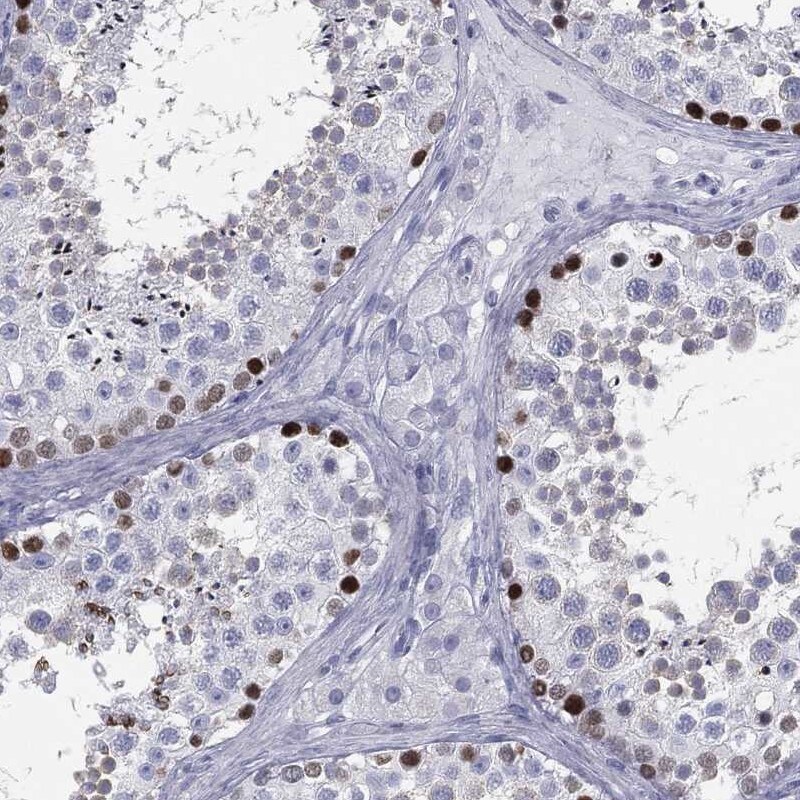 ESX1 Antibody Immunohistochemistry-Paraffin: ESX1 Antibody [NBP3-24824]