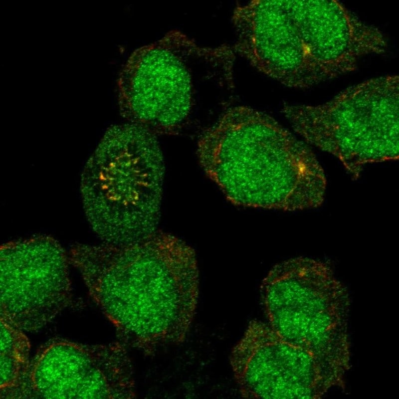 FANCE Antibody Immunocytochemistry/Immunofluorescence: FANCE Antibody [NBP3-24840]
