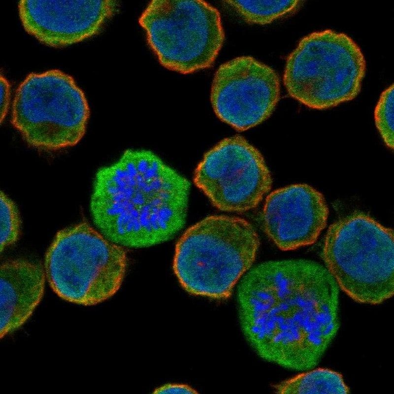 FFAR1/GPR40 Antibody Immunocytochemistry/Immunofluorescence: FFAR1/GPR40 Antibody [NBP3-24846]