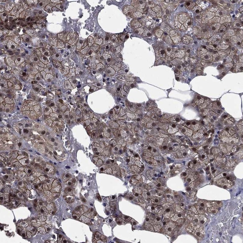 FGD1 Antibody Immunohistochemistry-Paraffin: FGD1 Antibody [NBP3-24847]
