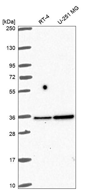 Fructosamine-3-kinase-related Antibody Western Blot: Fructosamine-3-kinase-related Antibody [NBP3-24856]