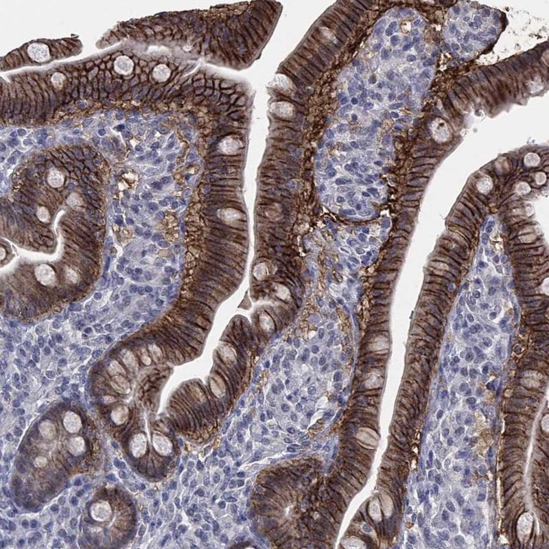 Glut2 Antibody Immunohistochemistry-Paraffin: Glut2 Antibody [NBP3-24872]