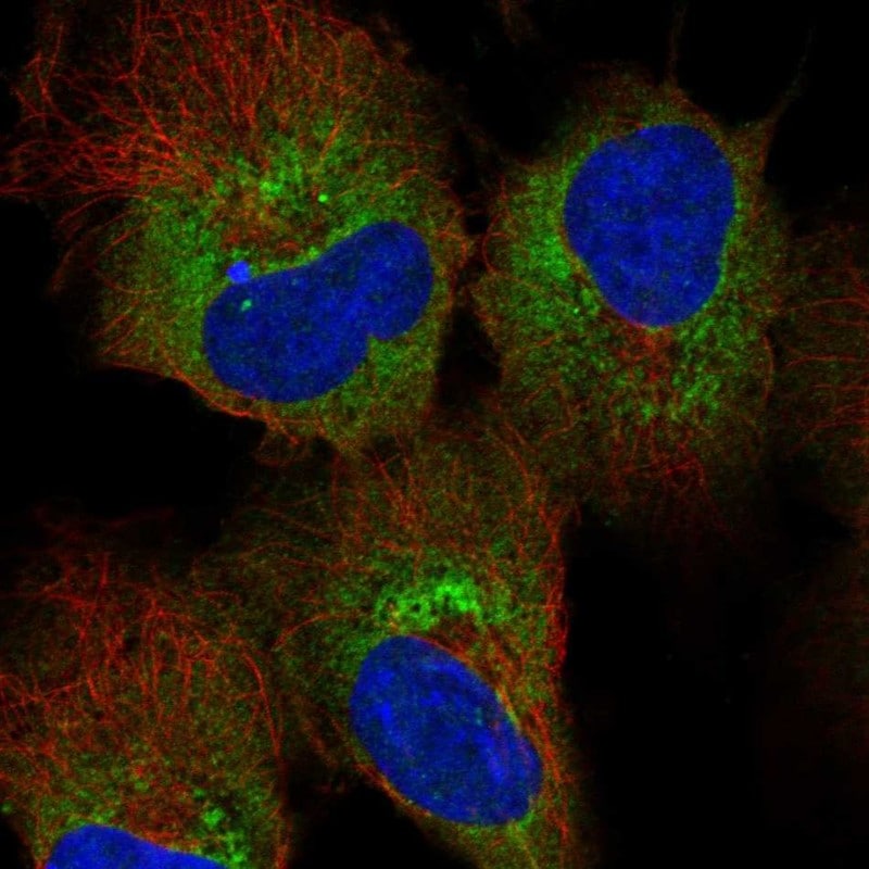 HDLBP Antibody Immunocytochemistry/Immunofluorescence: HDLBP Antibody [NBP3-24896]