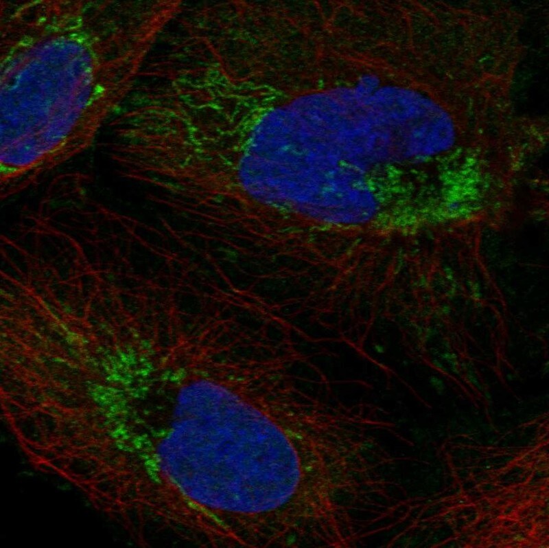 ICT Antibody Immunocytochemistry/Immunofluorescence: ICT Antibody [NBP3-24906]