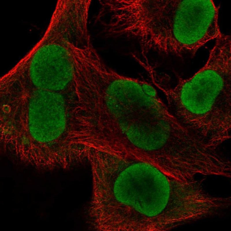 IFI16 Antibody Immunocytochemistry/Immunofluorescence: IFI16 Antibody [NBP3-24908]