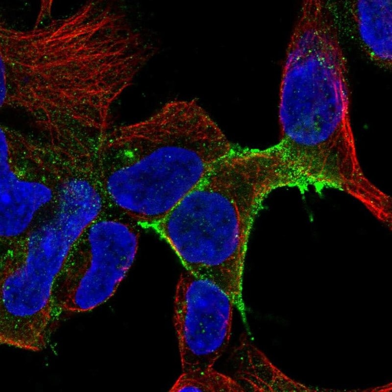 IL-11R alpha Antibody Immunocytochemistry/Immunofluorescence: IL-11R alpha Antibody [NBP3-24911]