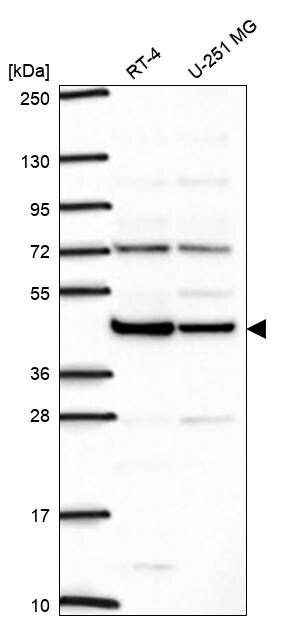 ILF2 Antibody Western Blot: ILF2 Antibody [NBP3-24914]