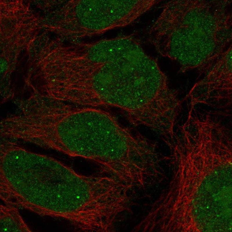 INAVA Antibody Immunocytochemistry/Immunofluorescence: INAVA Antibody [NBP3-24917]