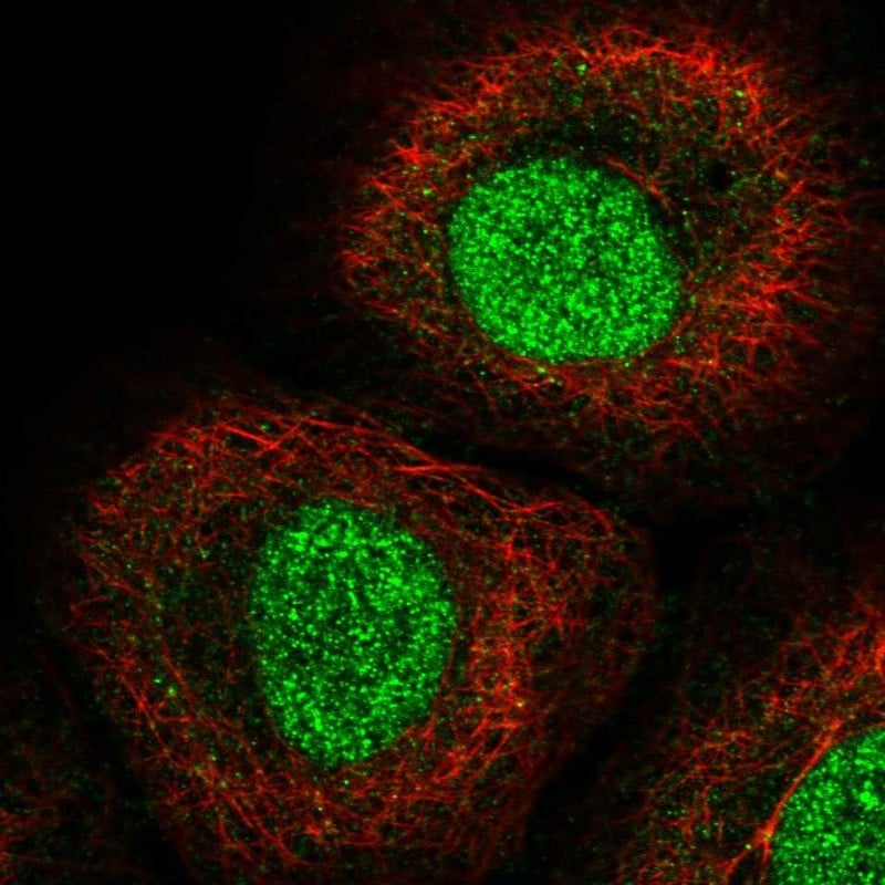 IRF1 Antibody Immunocytochemistry/Immunofluorescence: IRF1 Antibody [NBP3-24921]