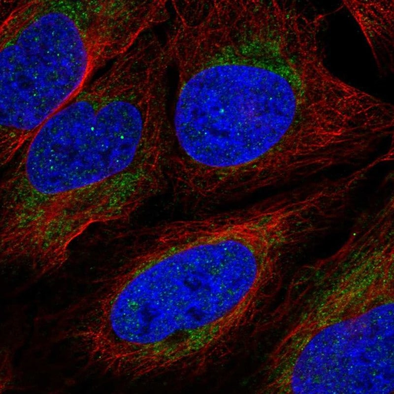 IRG1 Antibody Immunocytochemistry/Immunofluorescence: IRG1 Antibody [NBP3-24922]