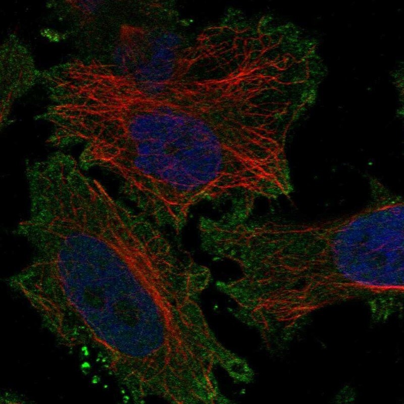 Kv8.1 Antibody Immunocytochemistry/Immunofluorescence: Kv8.1 Antibody [NBP3-24949]