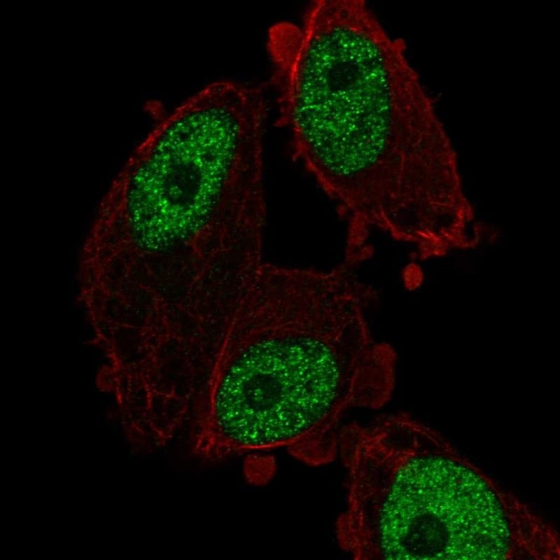 MED26 Antibody - BSA Free Immunocytochemistry/ Immunofluorescence: MED26 Antibody - BSA Free [NBP3-24977]