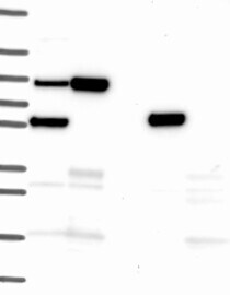 MEKK3 Antibody Western Blot: MEKK3 Antibody [NBP3-24979]