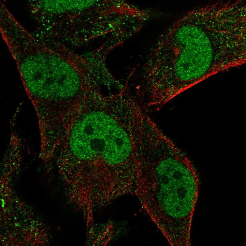 MLIP Antibody Immunocytochemistry/Immunofluorescence: MLIP Antibody [NBP3-24984]