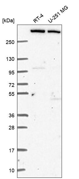 MLL3 Antibody Western Blot: MLL3 Antibody [NBP3-24985]