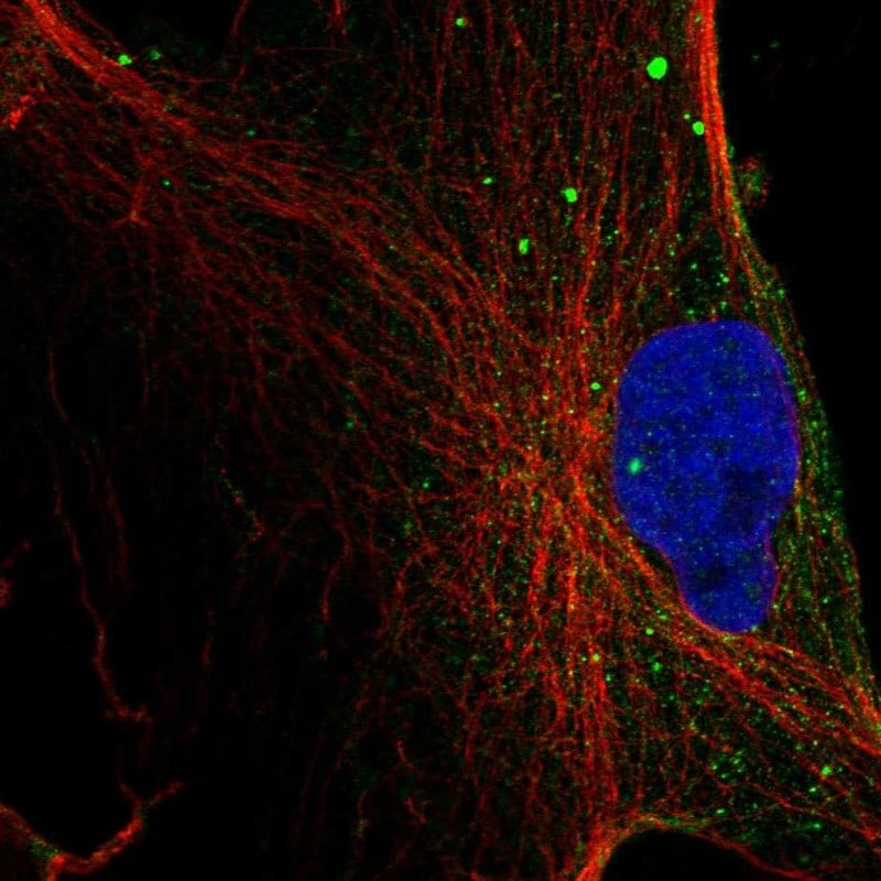 Monoglyceride Lipase Antibody - BSA Free Immunocytochemistry/ Immunofluorescence: Monoglyceride Lipase Antibody - BSA Free [NBP3-24988]