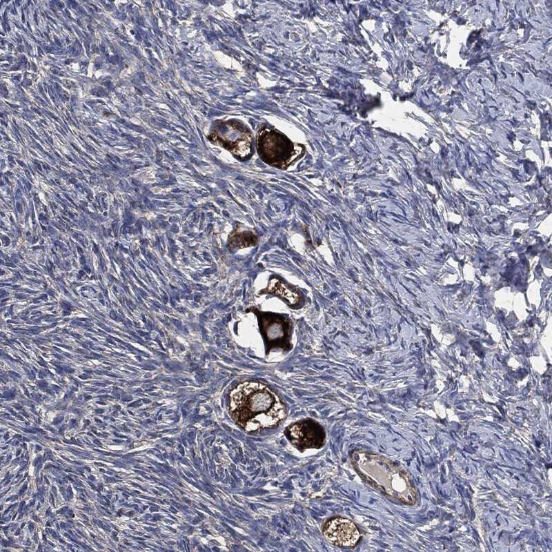 MST2/STK3 Antibody Immunohistochemistry-Paraffin: MST2/STK3 Antibody [NBP3-24997]