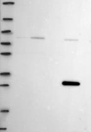 MST2/STK3 Antibody Western Blot: MST2/STK3 Antibody [NBP3-24997]
