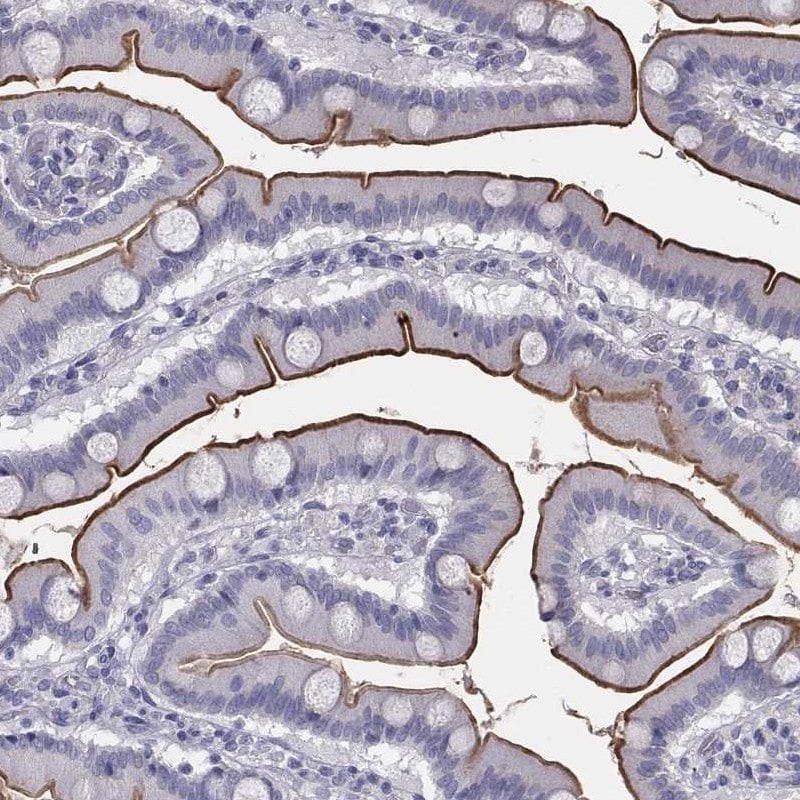 MUC13 Antibody Immunohistochemistry-Paraffin: MUC13 Antibody [NBP3-24999]