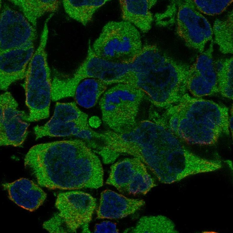 N4BP2L1 Antibody Immunocytochemistry/Immunofluorescence: N4BP2L1 Antibody [NBP3-25004]