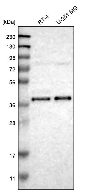 NDRG4 Antibody Western Blot: NDRG4 Antibody [NBP3-25006]