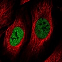 NEK5 Antibody Immunocytochemistry/Immunofluorescence: NEK5 Antibody [NBP3-25008]
