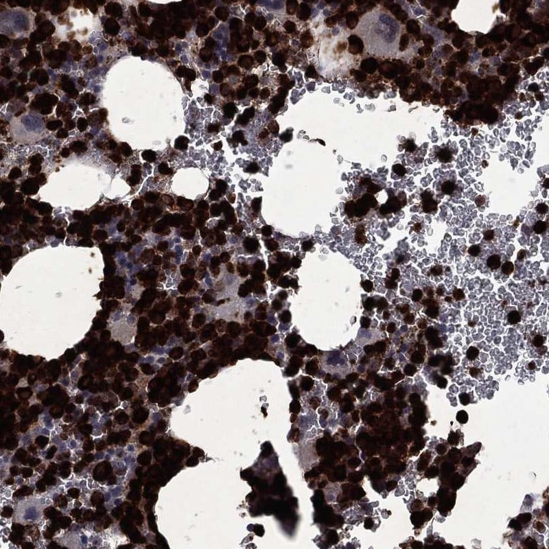 Neutrophil Elastase/ELA2 Antibody Immunohistochemistry-Paraffin: Neutrophil Elastase/ELA2 Antibody [NBP3-25010]