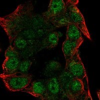 NFAT5 Antibody Immunocytochemistry/Immunofluorescence: NFAT5 Antibody [NBP3-25011]