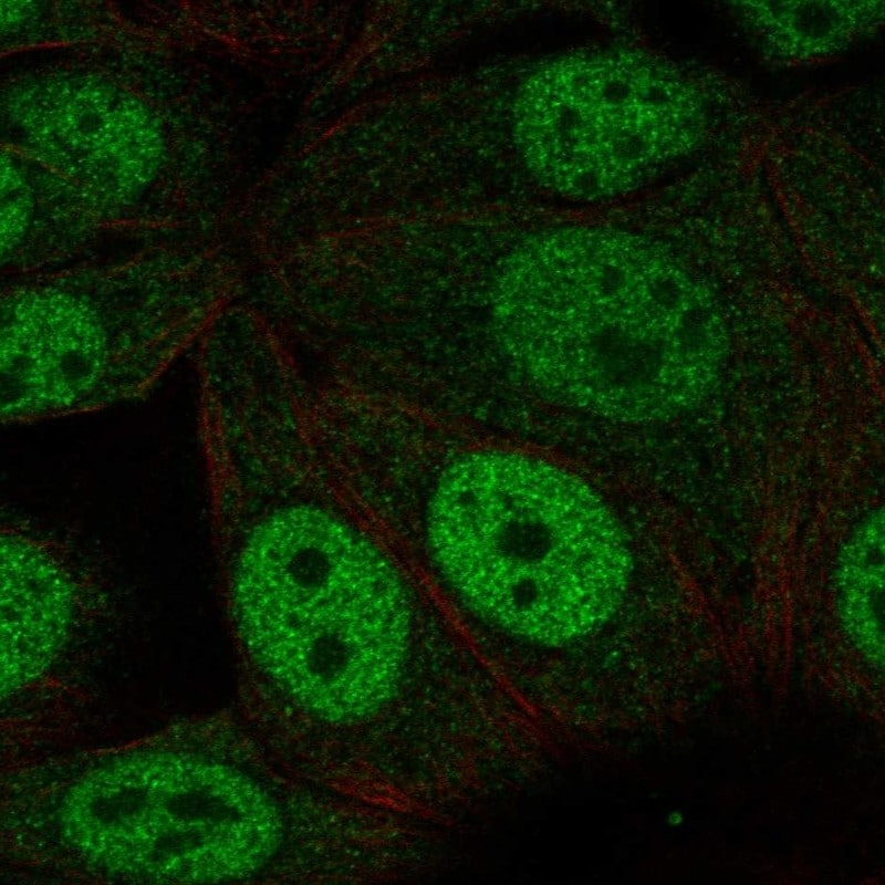 NHLRC1 Antibody Immunocytochemistry/Immunofluorescence: NHLRC1 Antibody [NBP3-25014]