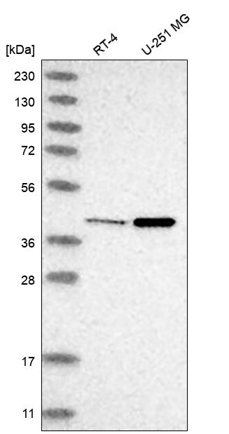 NME7 Antibody Western Blot: NME7 Antibody [NBP3-25020]