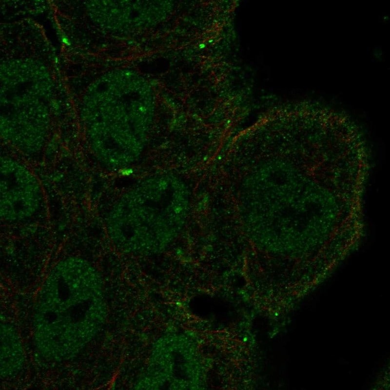 Notch-3 Antibody Immunocytochemistry/Immunofluorescence: Notch-3 Antibody [NBP3-25021]