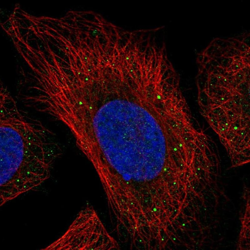 p40 Antibody - BSA Free Immunocytochemistry/ Immunofluorescence: p40 Antibody - BSA Free [NBP3-25036]