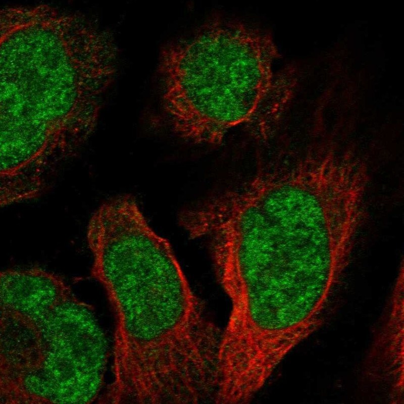 PBXIP1 Antibody Immunocytochemistry/Immunofluorescence: PBXIP1 Antibody [NBP3-25042]