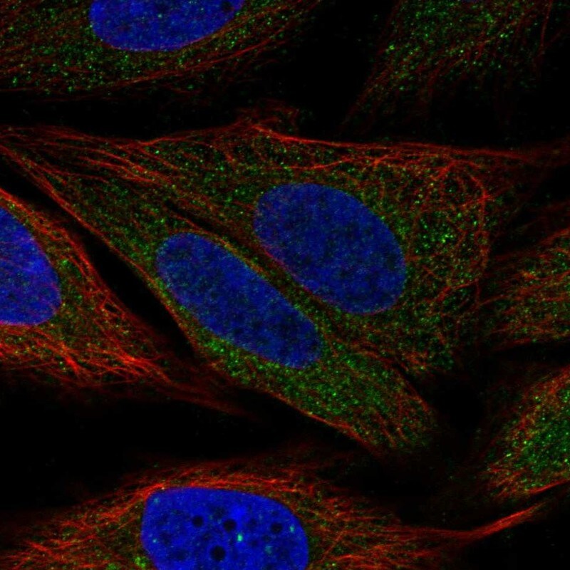 PDK-1 Antibody Immunocytochemistry/Immunofluorescence: PDK-1 Antibody [NBP3-25044]