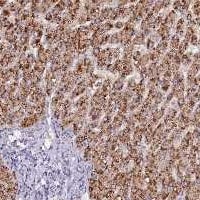 Pecanex Antibody Immunohistochemistry-Paraffin: Pecanex Antibody [NBP3-25046]